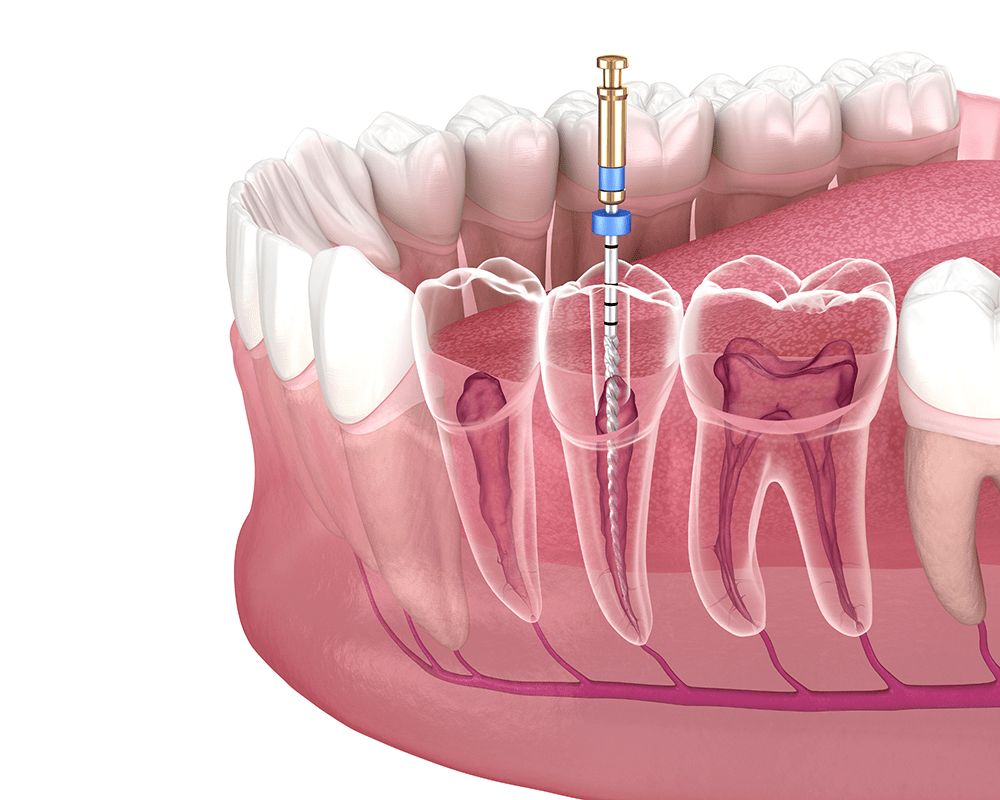 Endodoncija